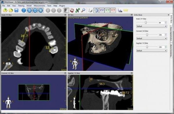 3DimViewer is an Open-source Free DICOM Viewer