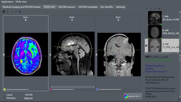 Aliza MS is a Free and Open-source DICOM Viewer for Linux and FreeBSD