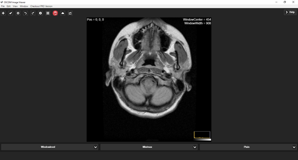Dicom Image Reader: Free App to Read and View DICOM (dcm) Image File