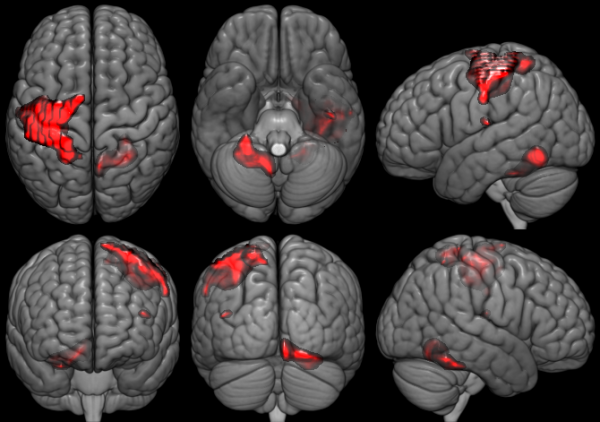 MRIcroGL: Open Siurce ICOM and NIFTI Viewer and Volume Renderer