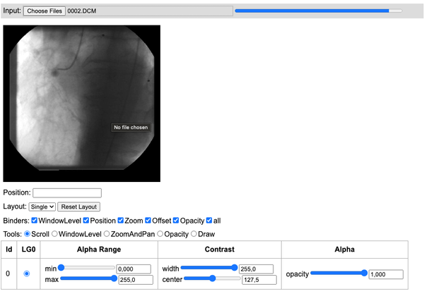 DWV (DICOM Web Viewer) is a Free Web-based DICOM Viewer